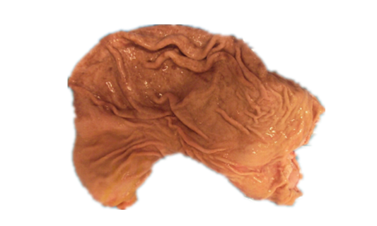 Stomach