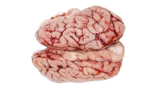 Brain
