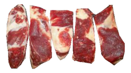 Short Intercostals/Rib Fingers